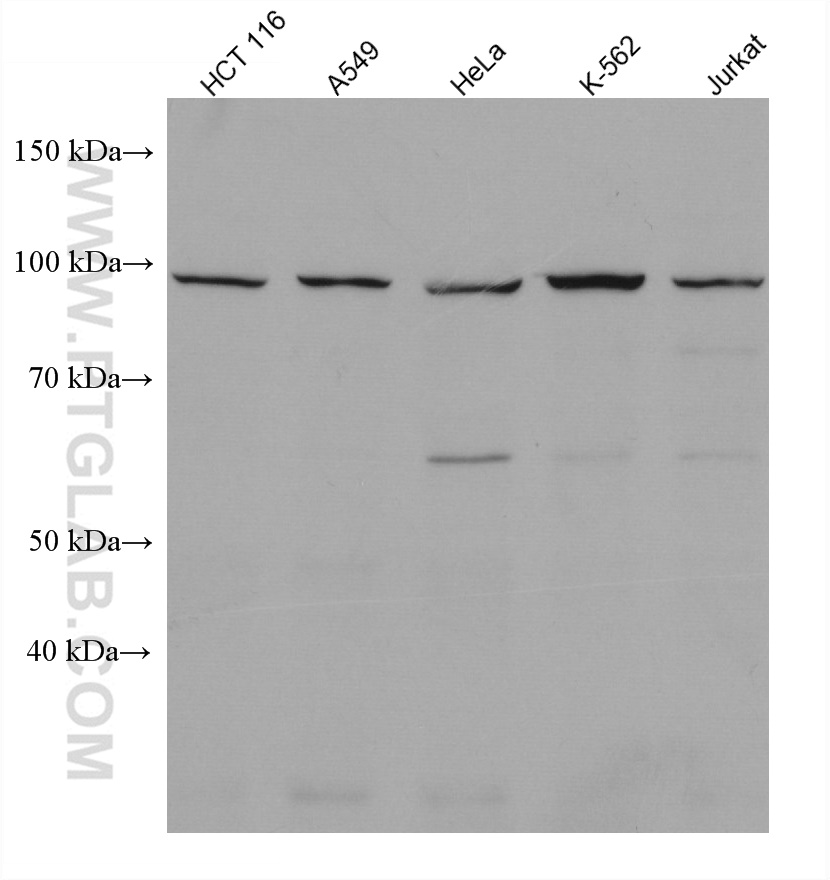 KDM1B Monoclonal antibody