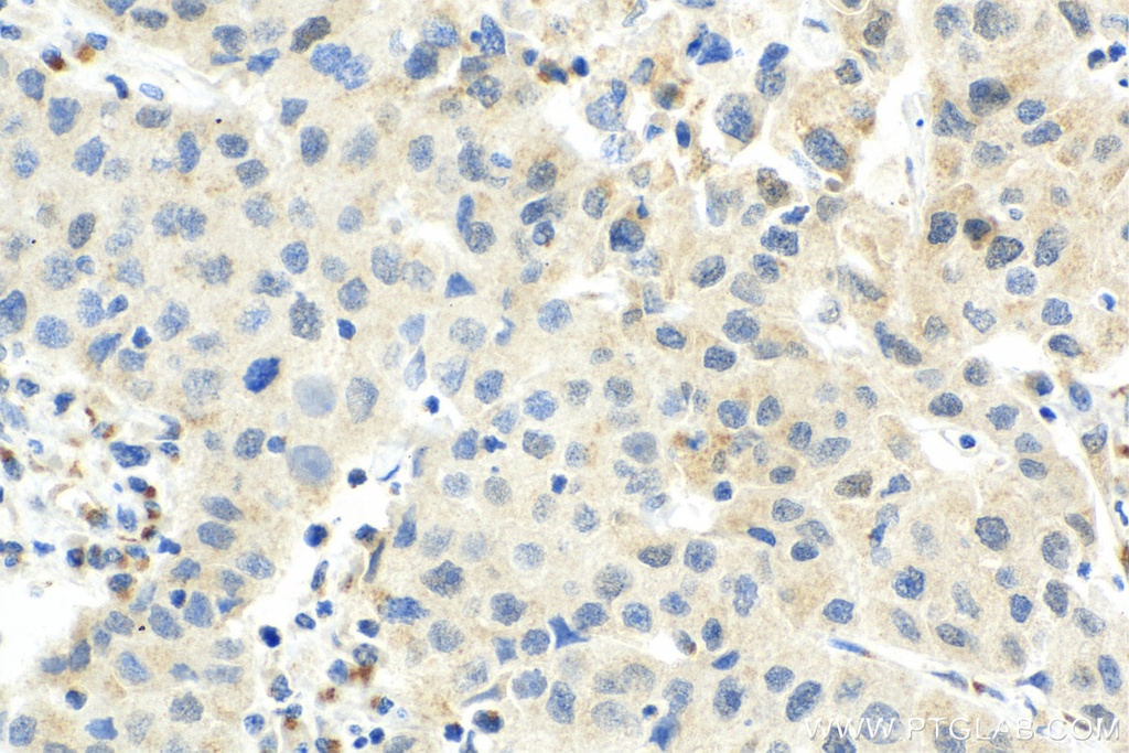 CDK7 Monoclonal antibody