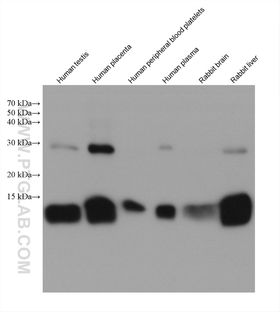 HBB Monoclonal antibody