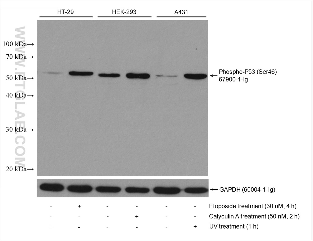 Phospho-P53 (Ser46) Monoclonal antibody