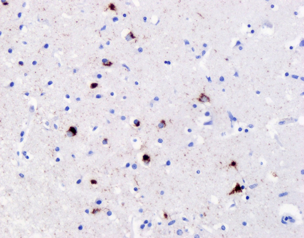 Phospho-TDP43 (Ser409/410) Recombinant antibody