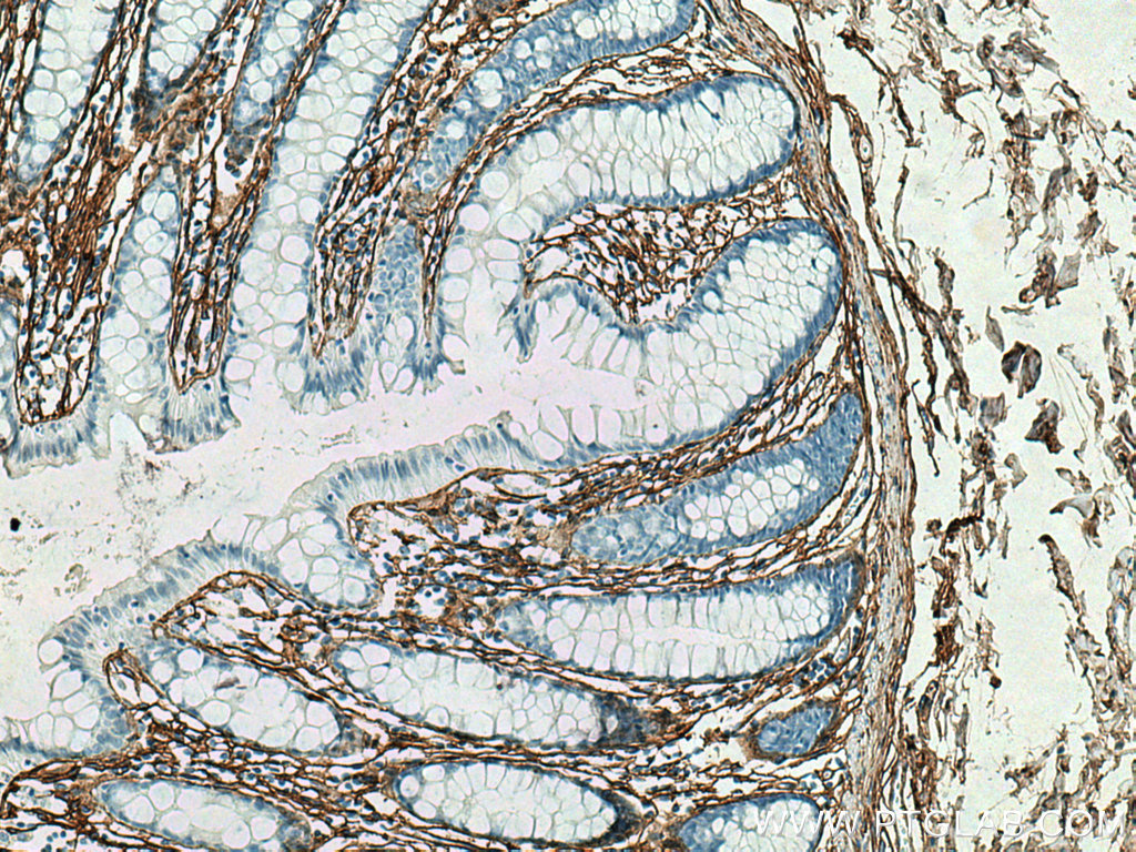 Collagen Type III (N-terminal) Recombinant antibody