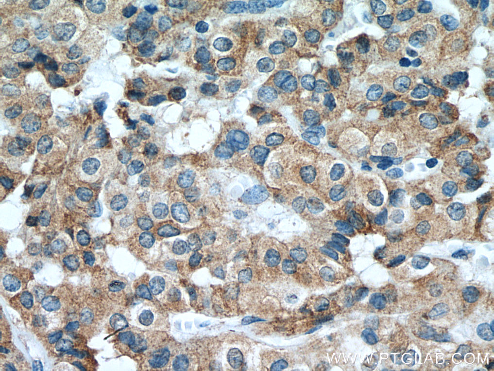 calreticulin Recombinant antibody