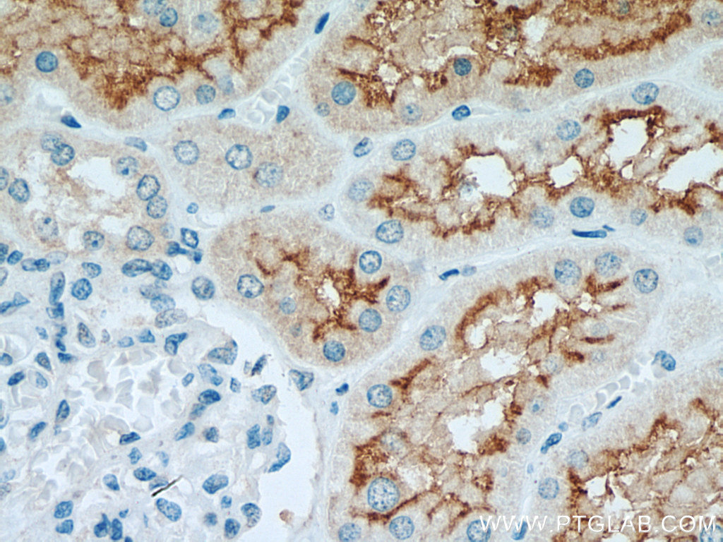 ACE2 Recombinant antibody