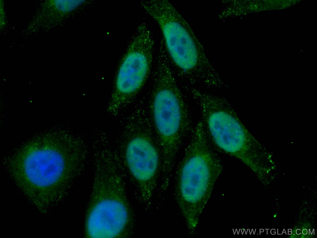 P53 Recombinant antibody