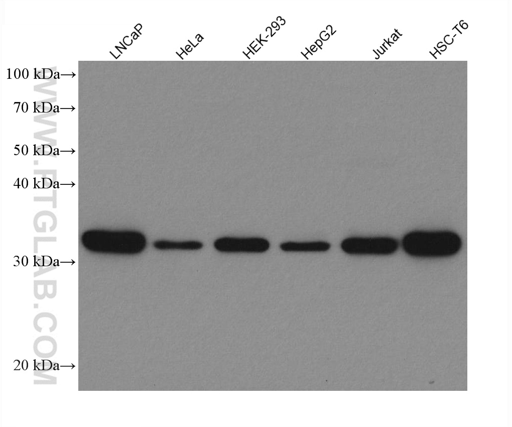 RPS6 Recombinant antibody