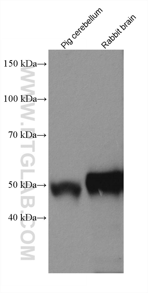 TTYH1 Recombinant antibody