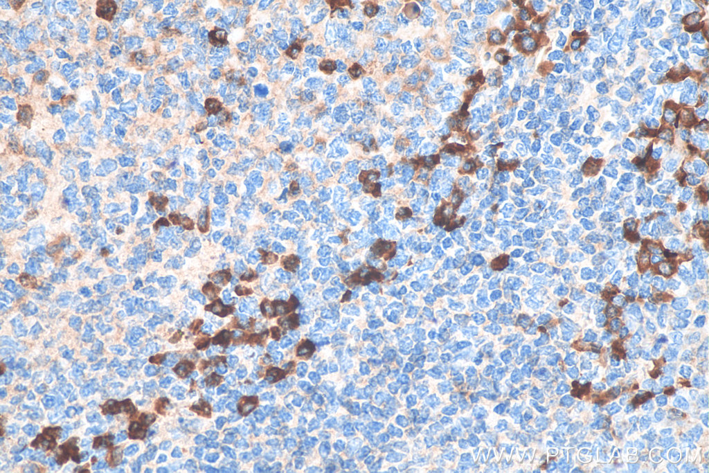 Biotin-conjugated Human IgG Polyclonal antibody
