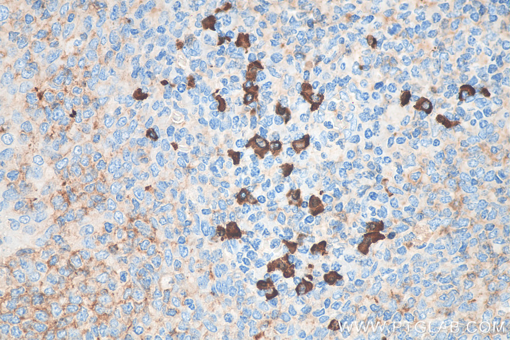 Biotin-conjugated Human IgA Heavy Chain Polyclonal antibody