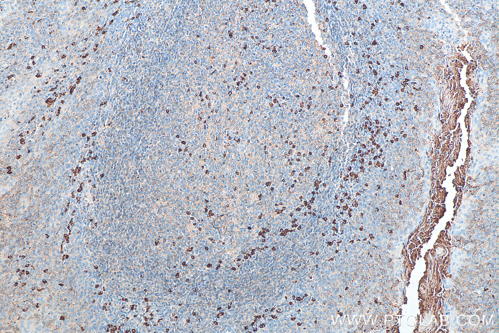 Biotin-conjugated IgG Lambda Light Chain Polyclonal antibody