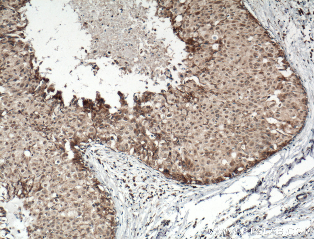 Biotin-conjugated DNAJB9 Polyclonal antibody