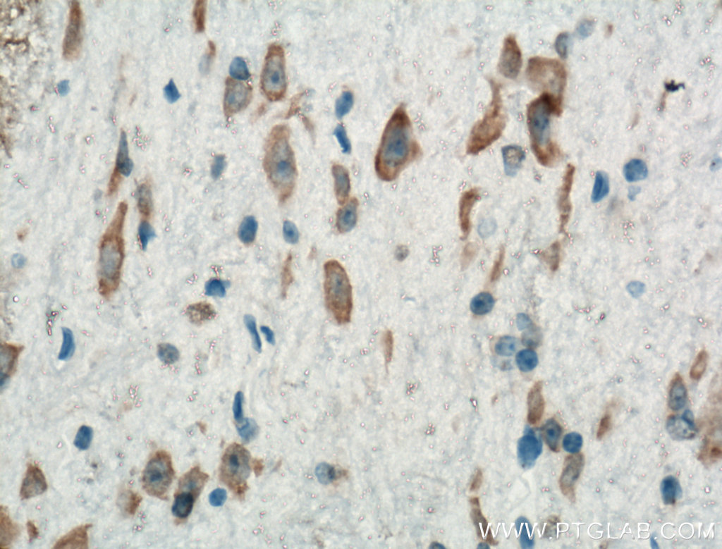 Biotin-conjugated PKM1-specific Polyclonal antibody