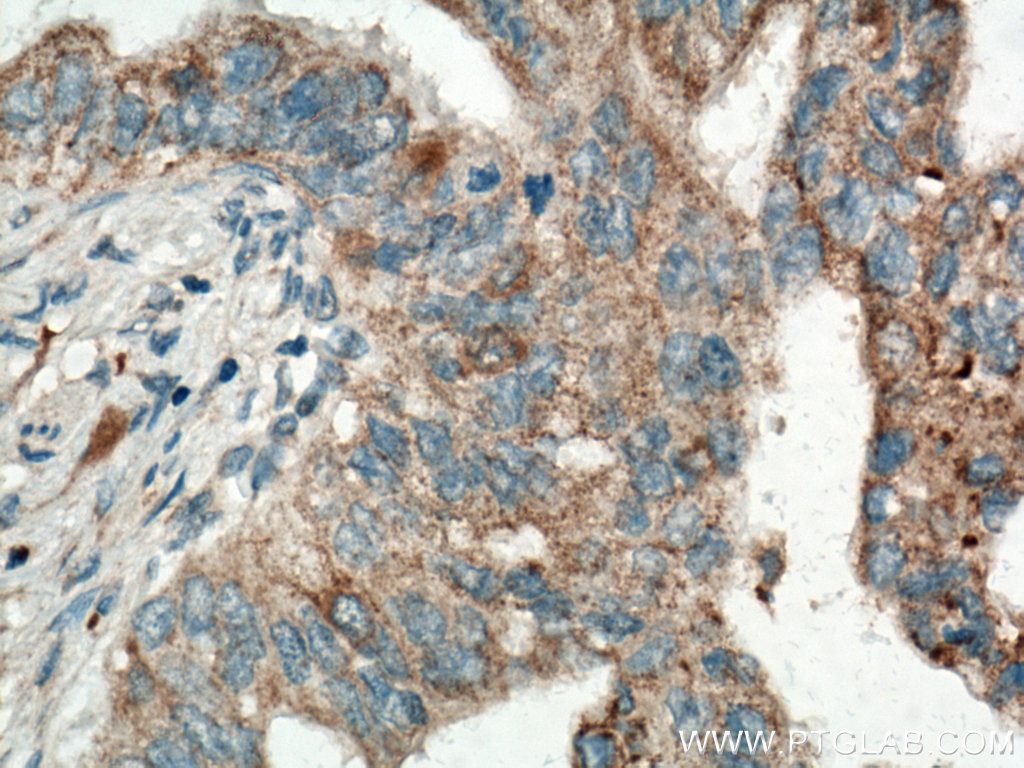 Biotin-conjugated OPTN Monoclonal antibody