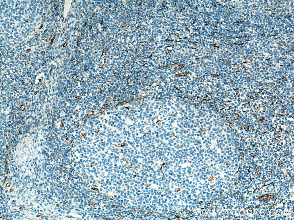 Biotin-conjugated Vimentin Monoclonal antibody