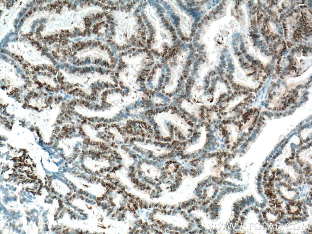 Biotin-conjugated PR Monoclonal antibody
