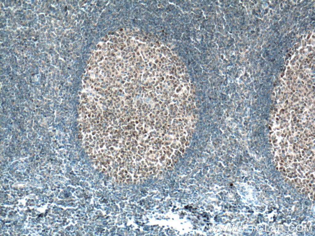 Biotin-conjugated BCL6 Monoclonal antibody