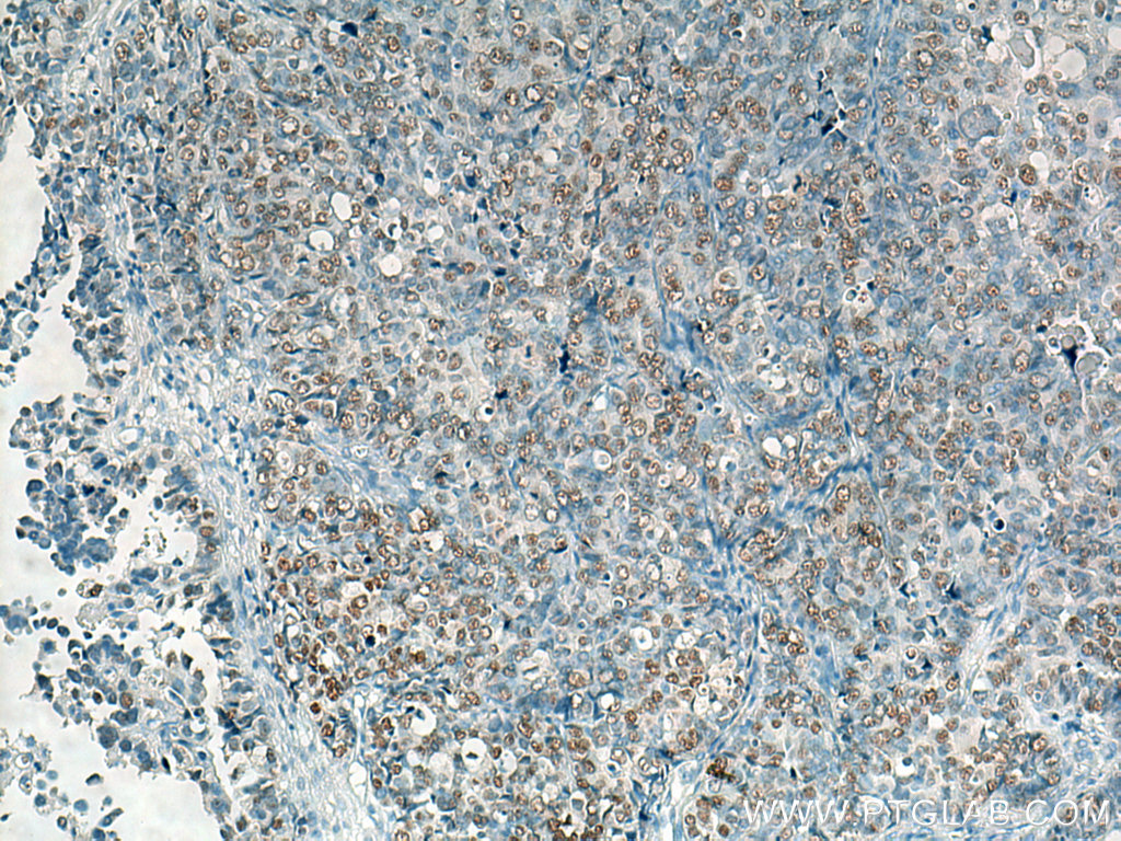 Biotin-conjugated Heavy chain of Rabbit IgG Monoclonal antibody