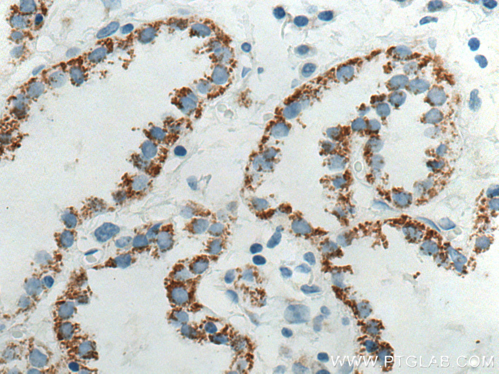 Biotin-conjugated Cytokeratin 7 Monoclonal antibody