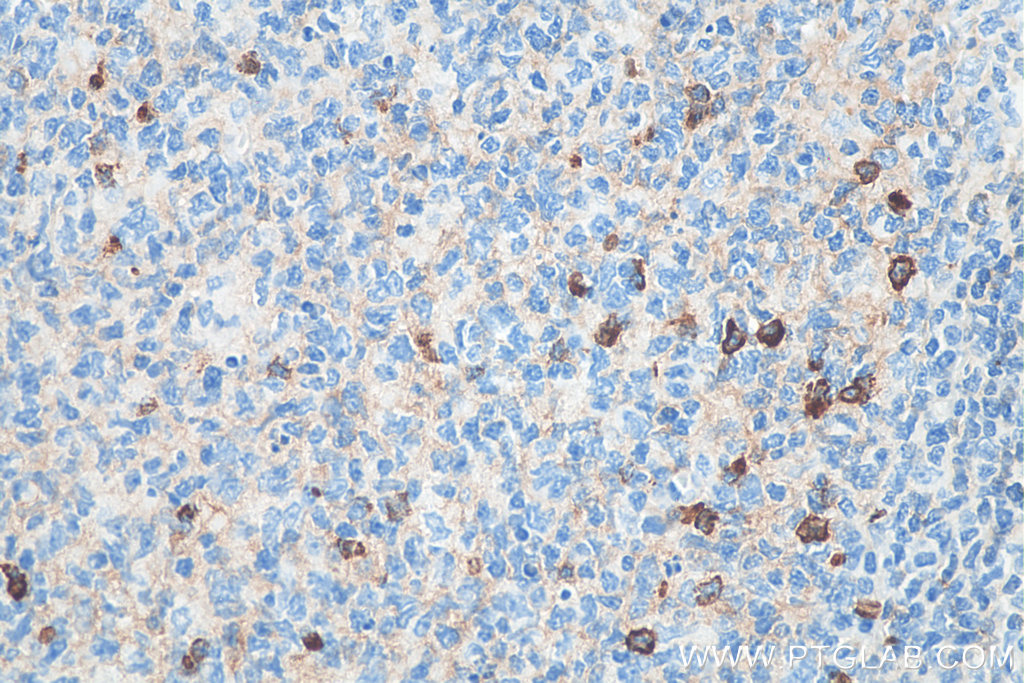 Biotin-conjugated human IgM Monoclonal antibody