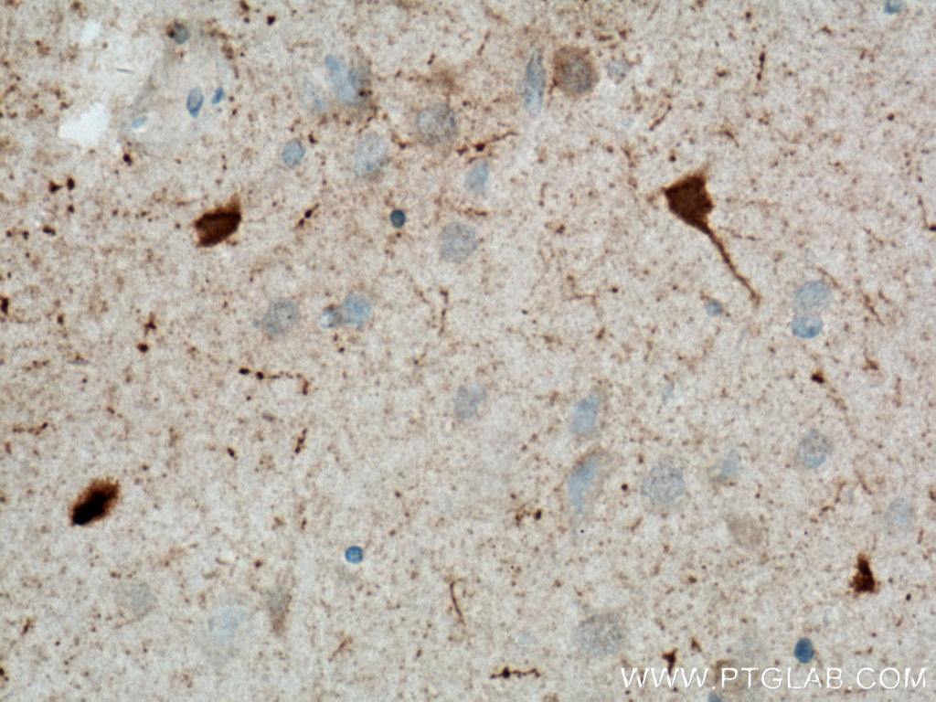 Biotin-conjugated Calretinin Monoclonal antibody