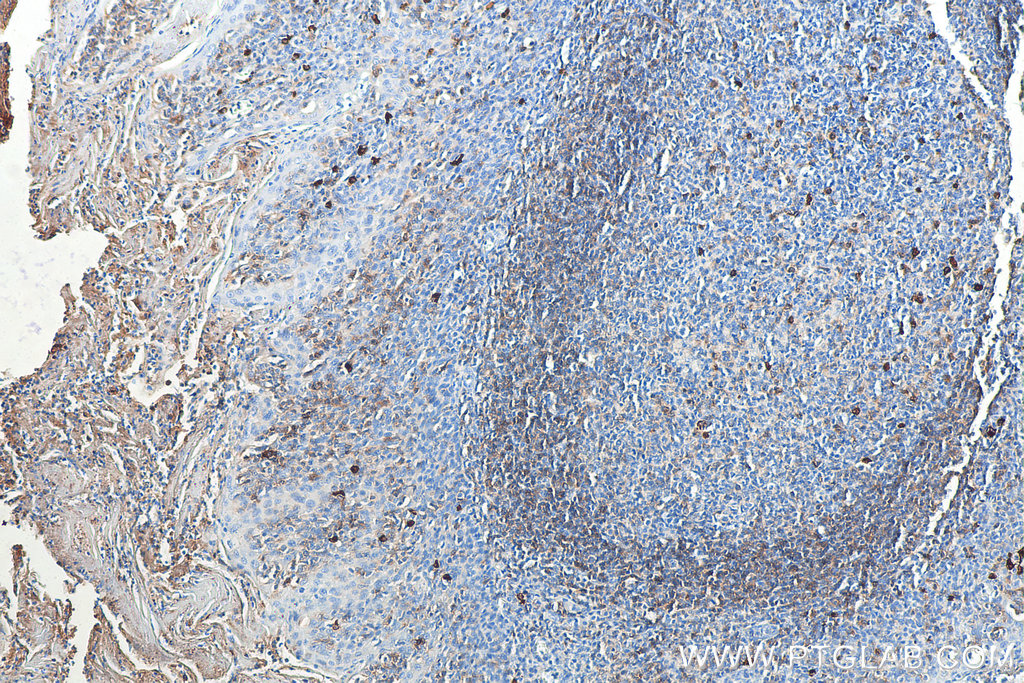 Biotin-conjugated IGHD Monoclonal antibody