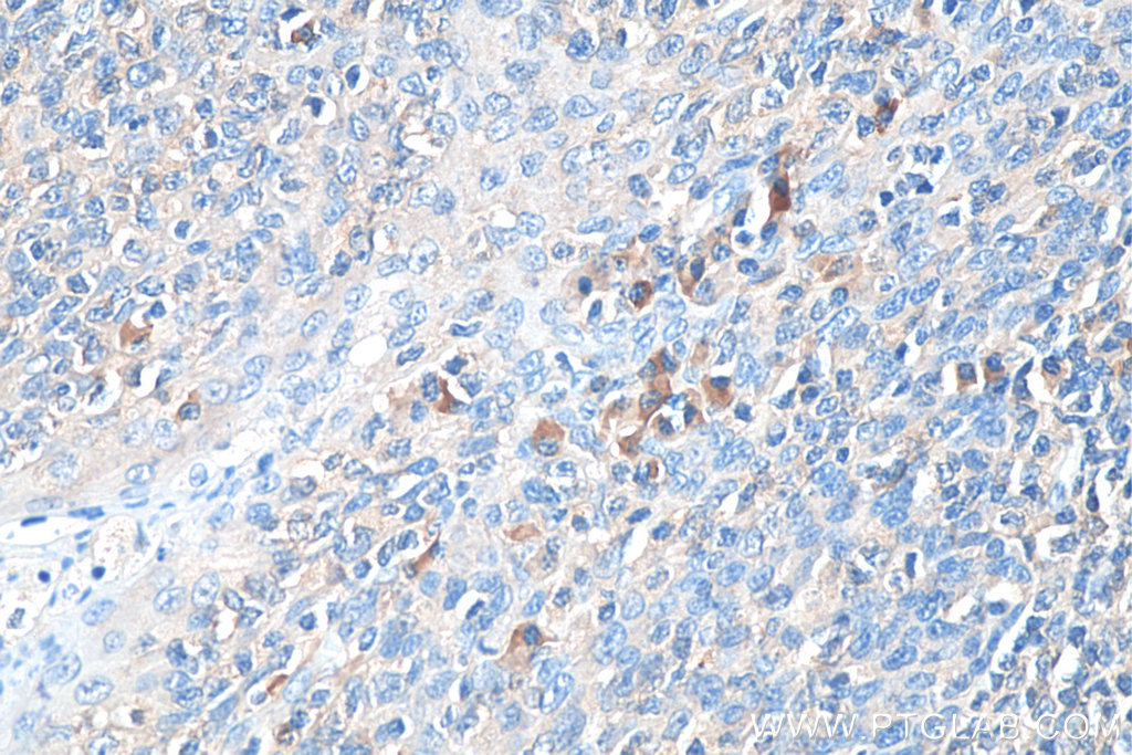 Biotin-conjugated Human IgG Kappa chain Monoclonal antibody