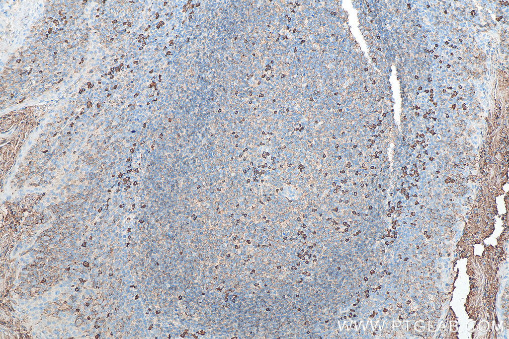 Biotin-conjugated Human IgG lambda chain Monoclonal antibody