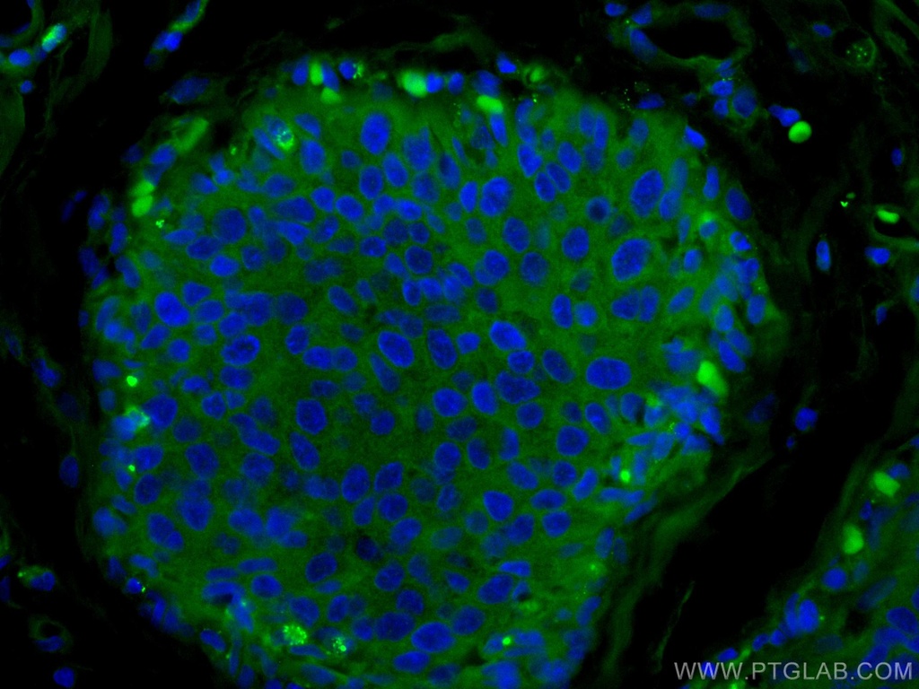 CoraLite®488-conjugated NDE1 Polyclonal antibody
