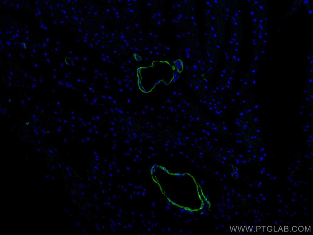 CoraLite®488-conjugated transgelin/SM22 Polyclonal antibody