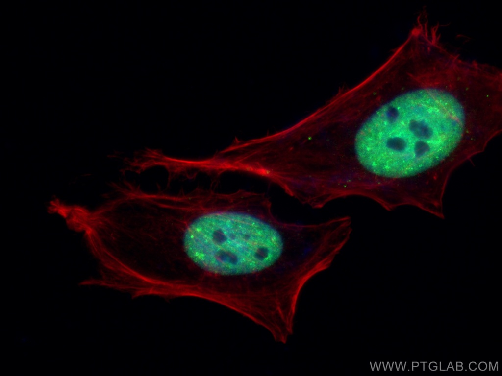 CoraLite®488-conjugated TDP-43 Polyclonal antibody
