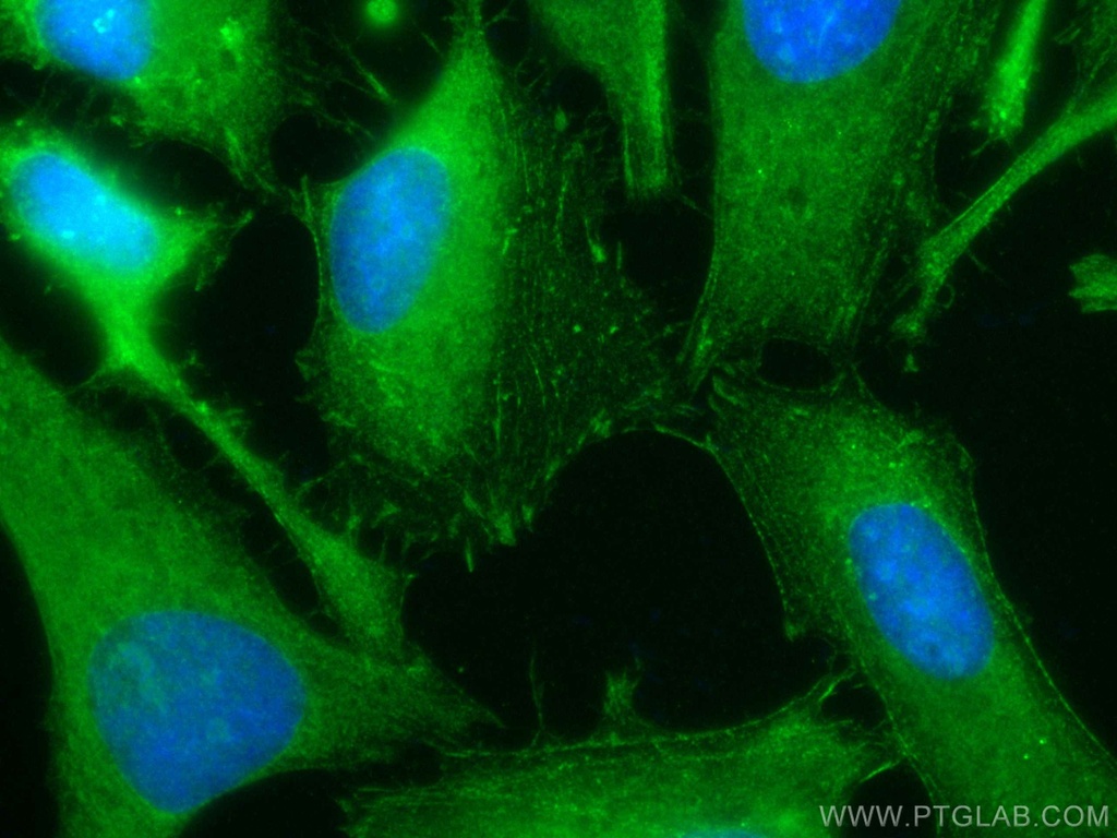 CoraLite®488-conjugated Palladin Polyclonal antibody