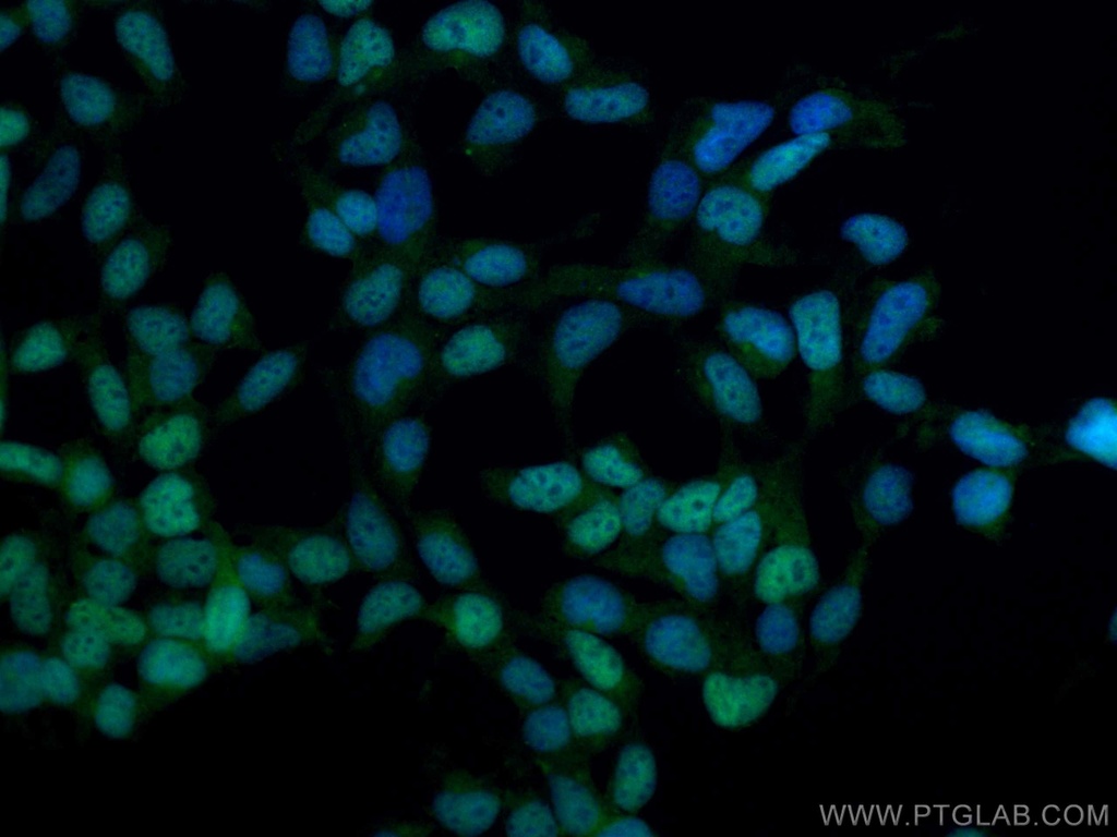 CoraLite®488-conjugated DACH1 Polyclonal antibody