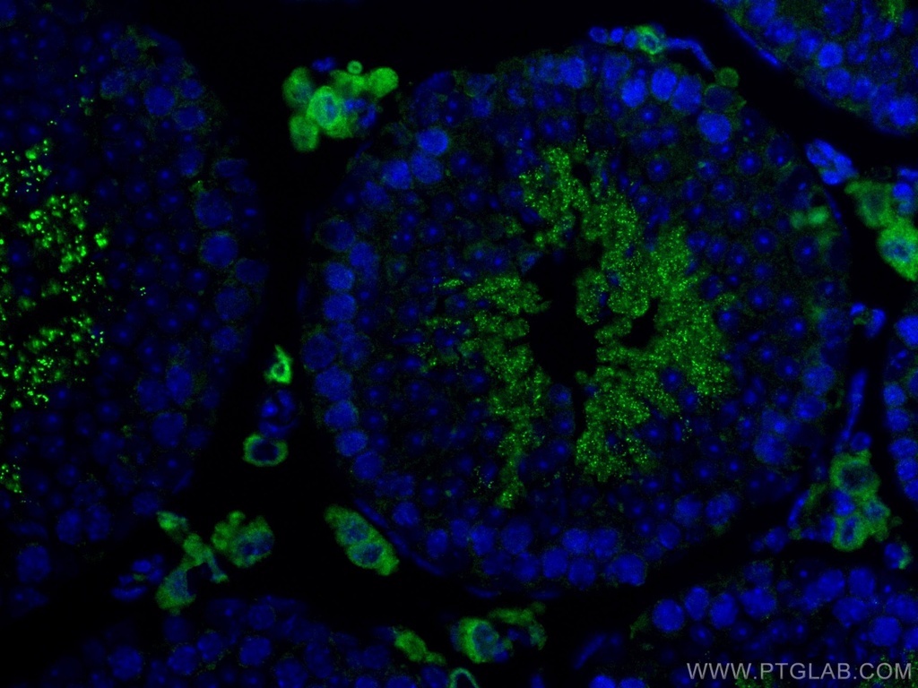 CoraLite®488-conjugated STAR Polyclonal antibody