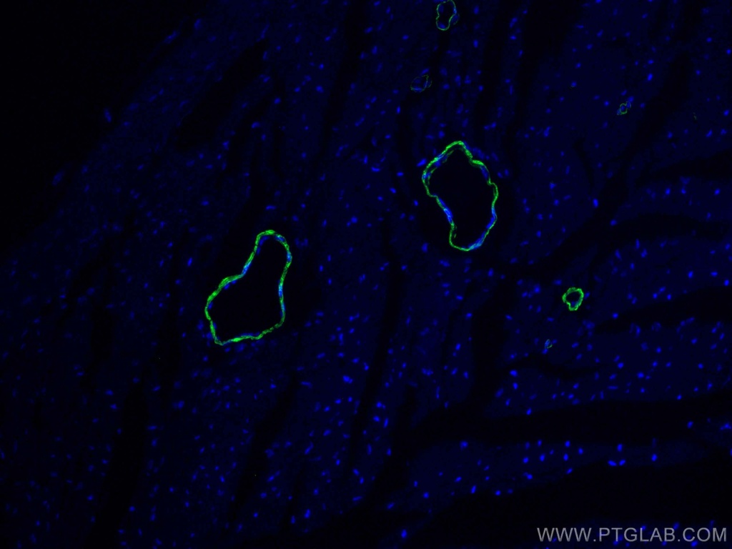 CoraLite®488-conjugated smooth muscle actin Polyclonal antibody