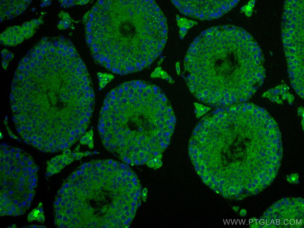 CoraLite®488-conjugated IFT140 Polyclonal antibody
