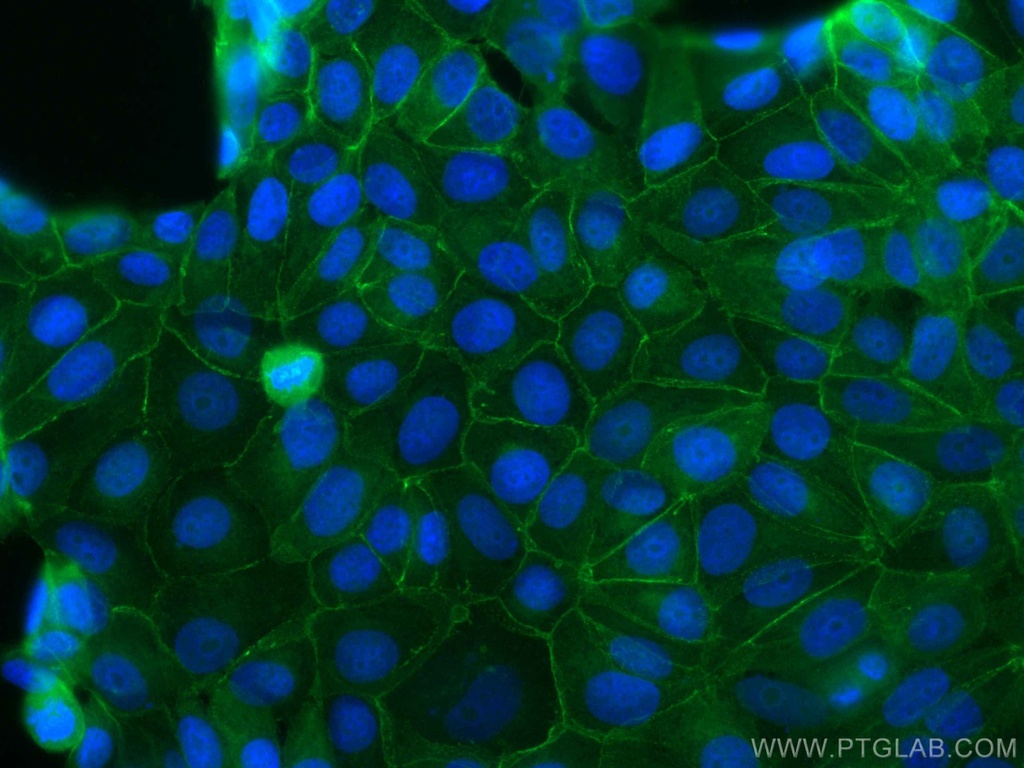 CoraLite®488-conjugated Beta Catenin Polyclonal antibody