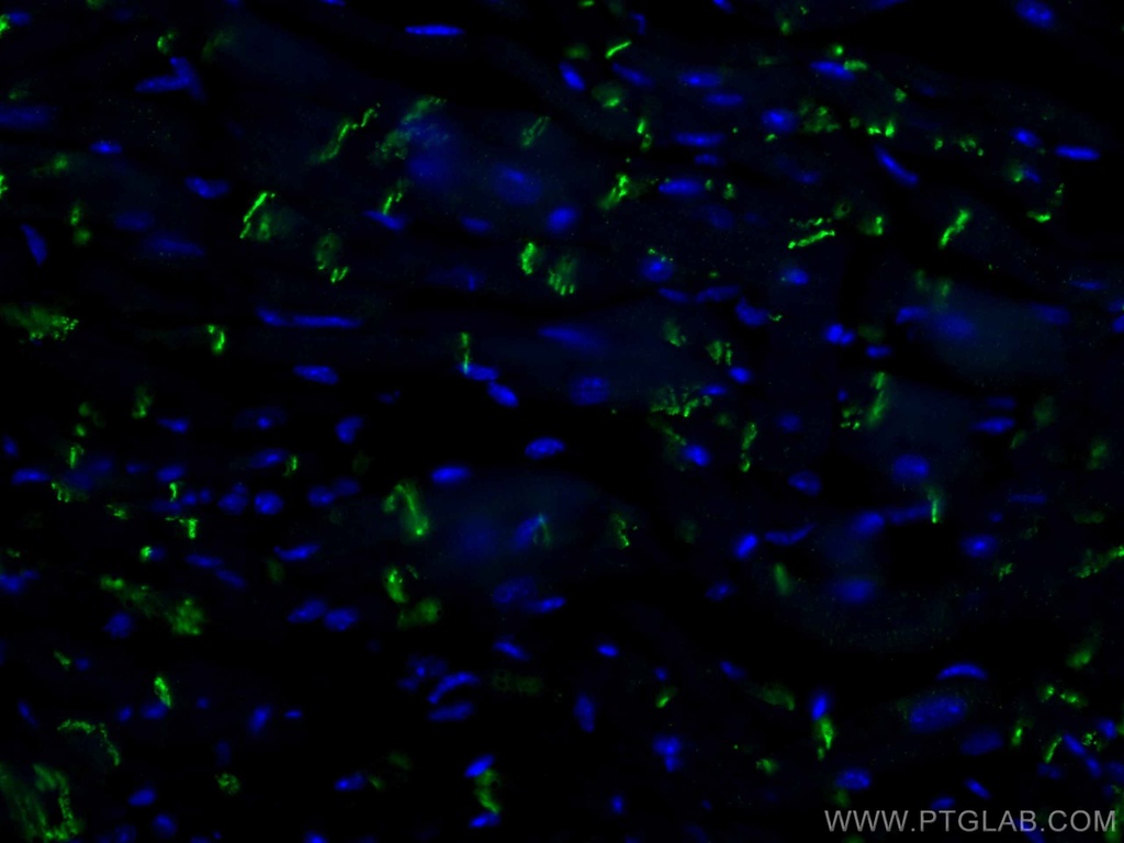CoraLite®488-conjugated N-cadherin Polyclonal antibody