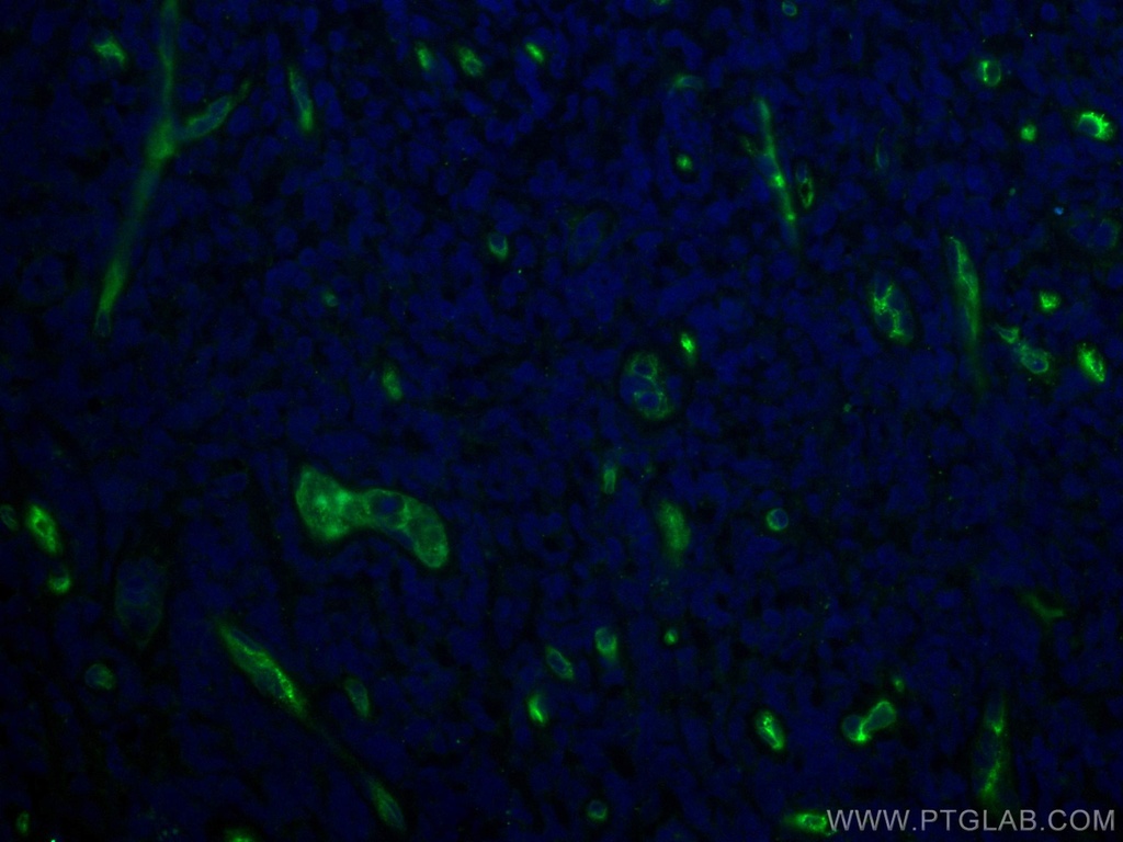 CoraLite®488-conjugated CD34 Monoclonal antibody