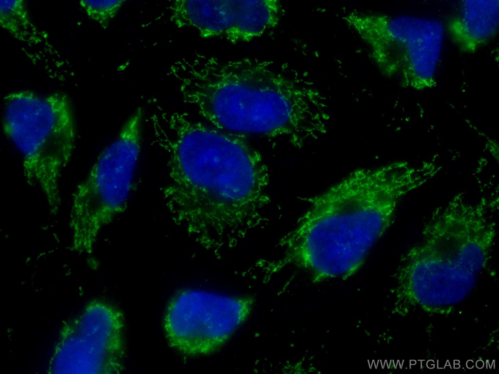 CoraLite®488-conjugated Napsin A Monoclonal antibody
