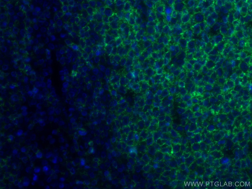 CoraLite®488-conjugated CD20 Monoclonal antibody