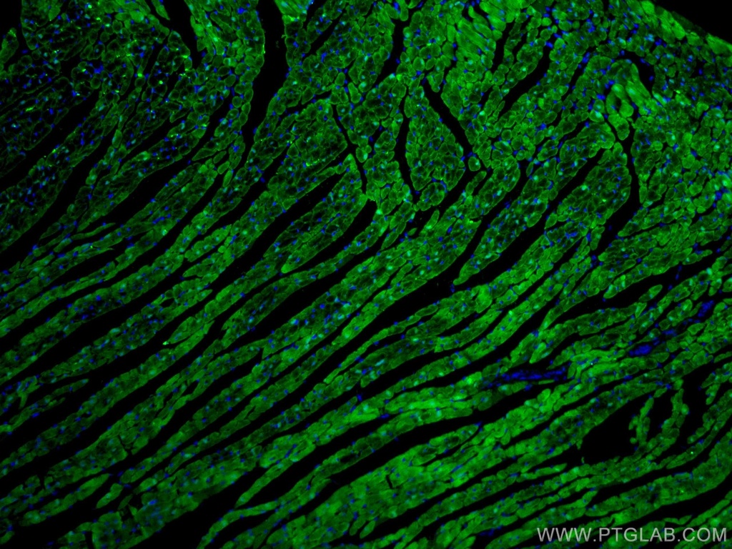 CoraLite®488-conjugated FABP3 Monoclonal antibody