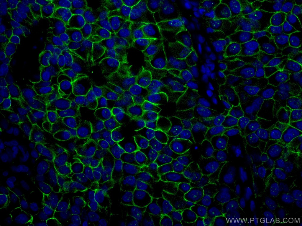 CoraLite®488-conjugated HER2/ErbB2 Monoclonal antibody