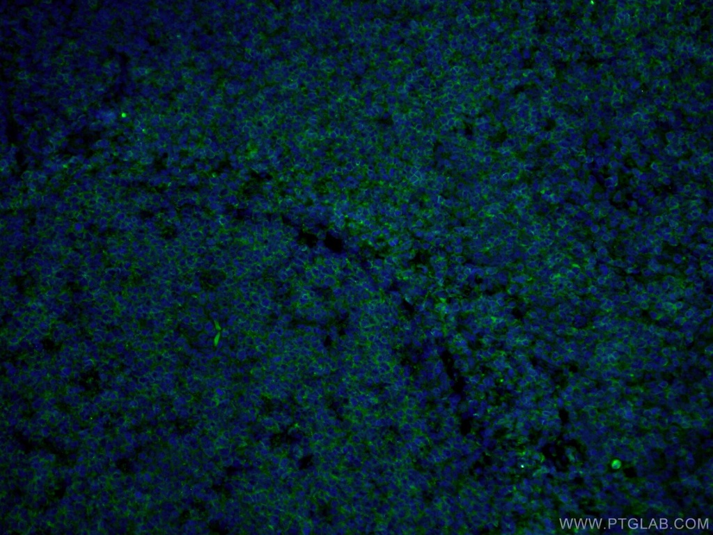 CoraLite®488-conjugated CD22 Monoclonal antibody