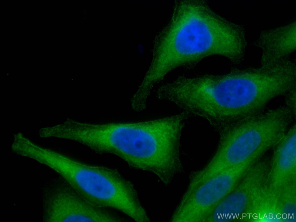 CoraLite®488-conjugated Aldolase C Monoclonal antibody