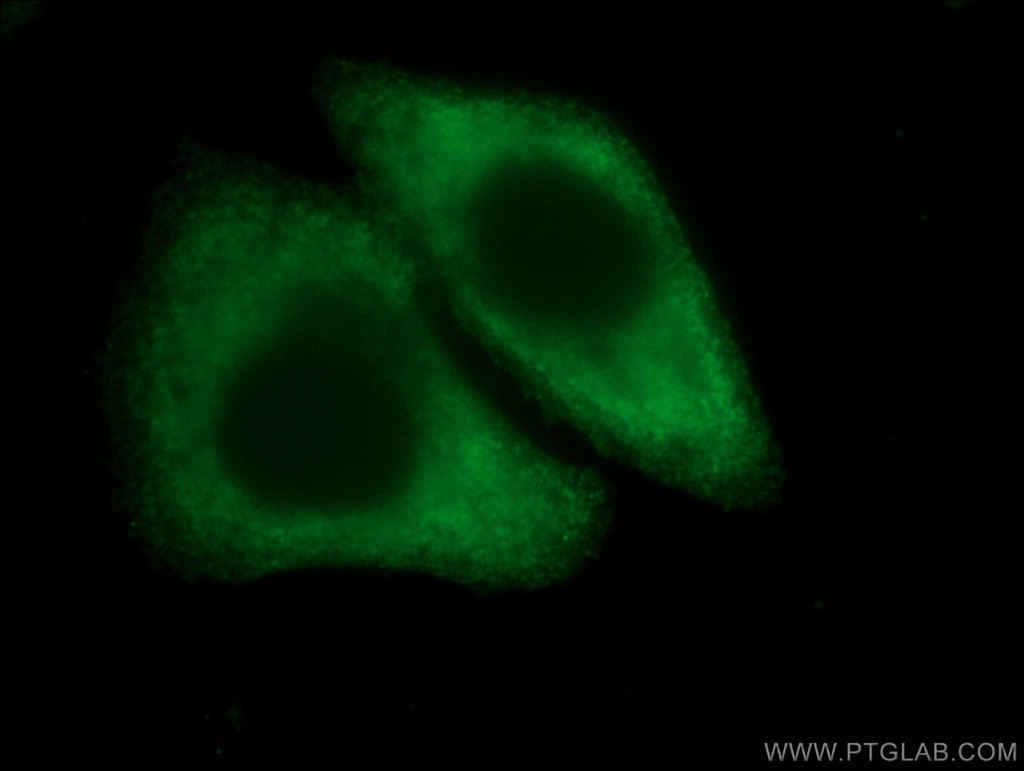 CoraLite®488-conjugated Arginase-1 Monoclonal antibody