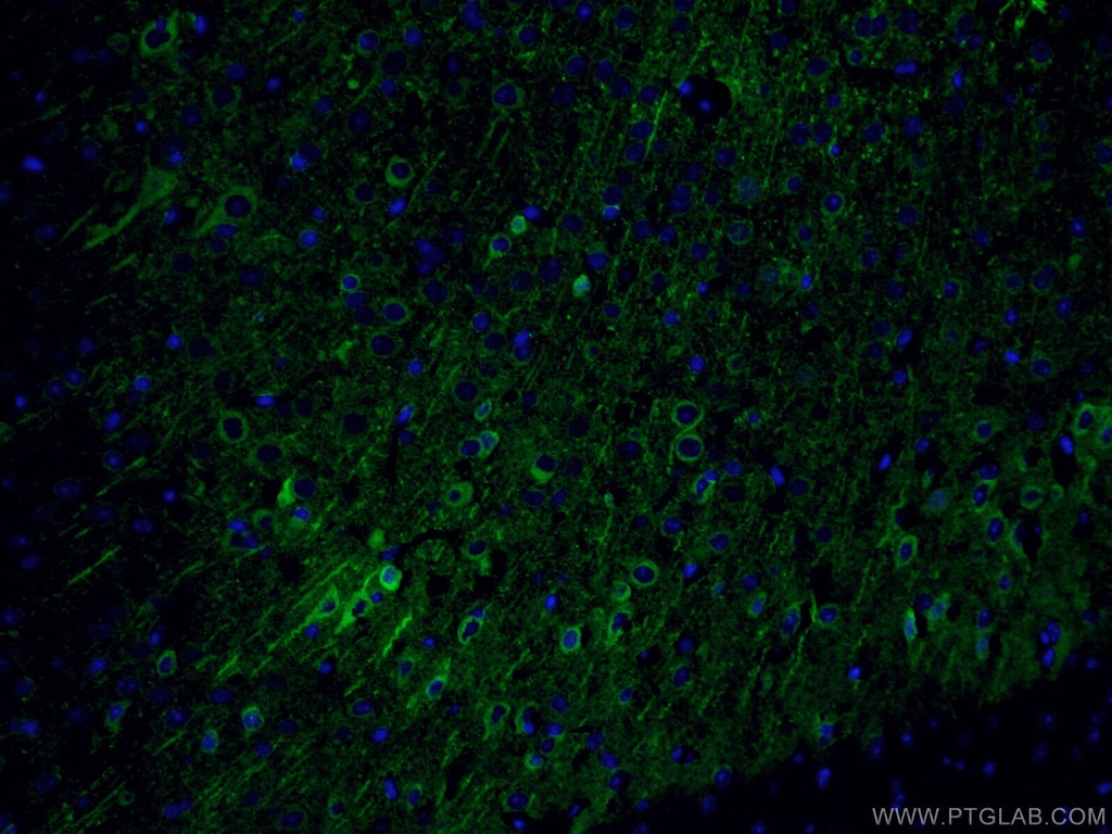 CoraLite®488-conjugated NSE Monoclonal antibody