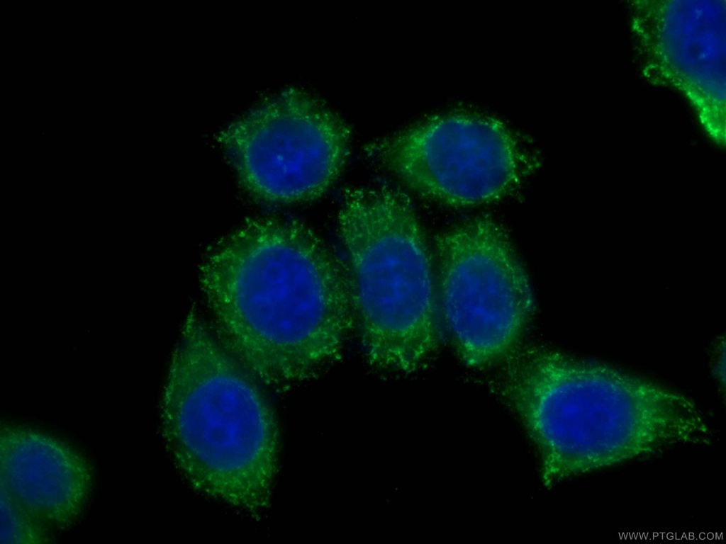 CoraLite®488-conjugated CLTCL1 Monoclonal antibody