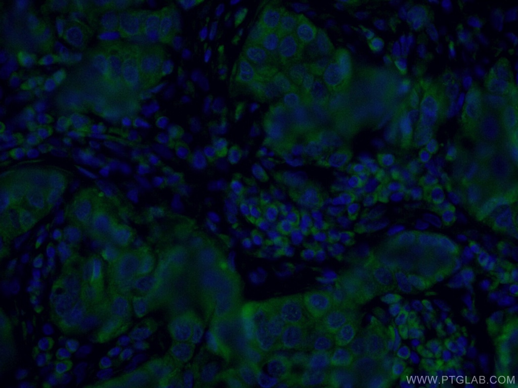 CoraLite®488-conjugated PADI2 Monoclonal antibody