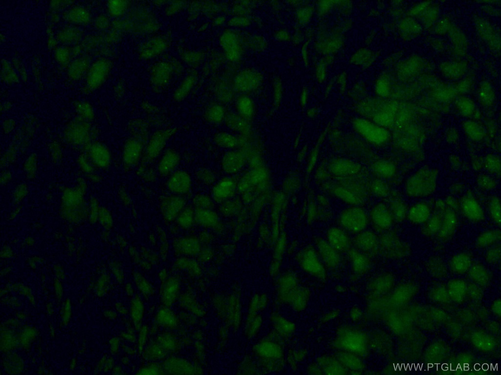 CoraLite®488-conjugated GATA3 Monoclonal antibody