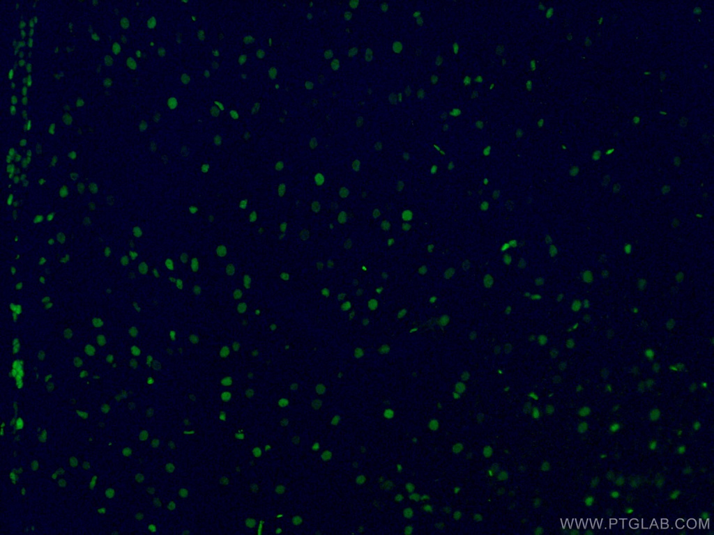 CoraLite®488-conjugated SOX2 Monoclonal antibody